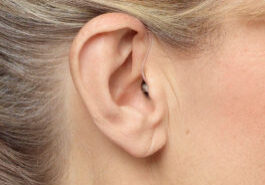hearing-aid-consuting